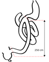 duodenal-switch-info