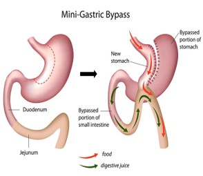 http://www.londonobesitycentre.com/wp-content/uploads/2020/04/OAGB.jpg